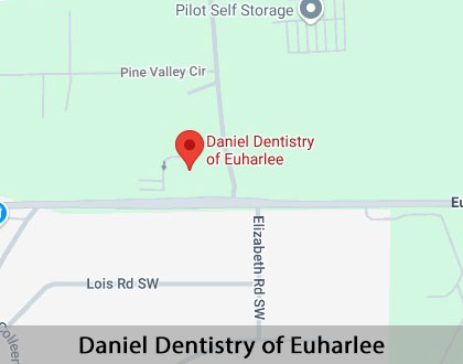 Map image for Dental Implants in Cartersville, GA