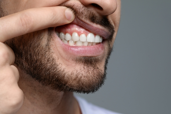 Supporting Successful Gum Disease Treatment